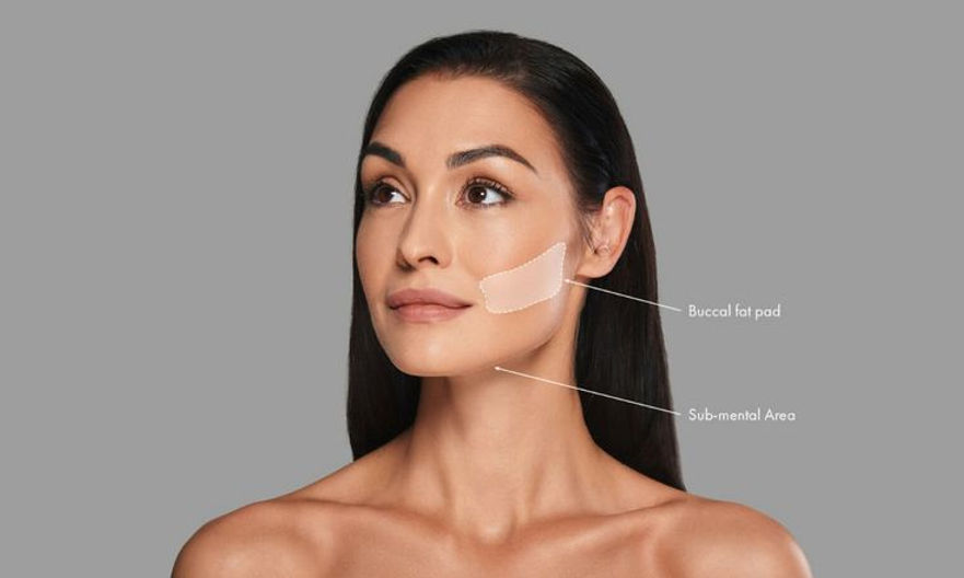 buccal fat.jpg