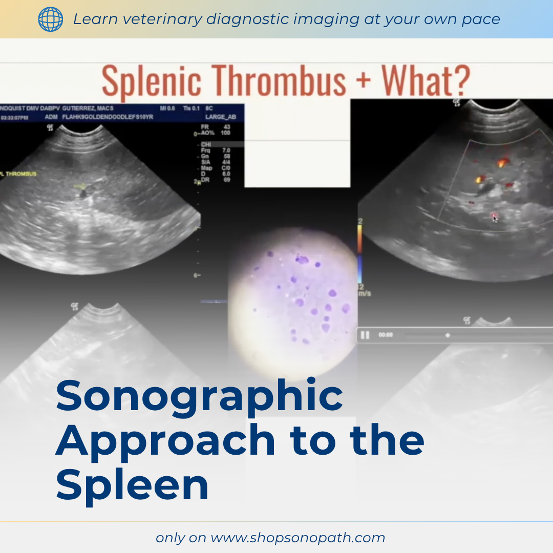 Sonographic Approach to the Spleen