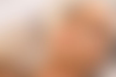 Natural Lip Fillers in Phoenix, AZ: Trusted Aesthetic Care