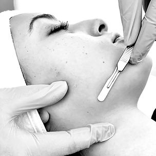 atalla-dermaplane-2020-web_edited.jpg