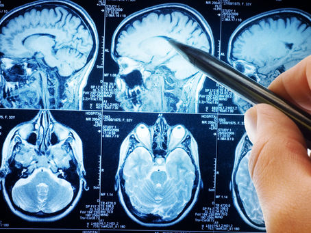 MRI
