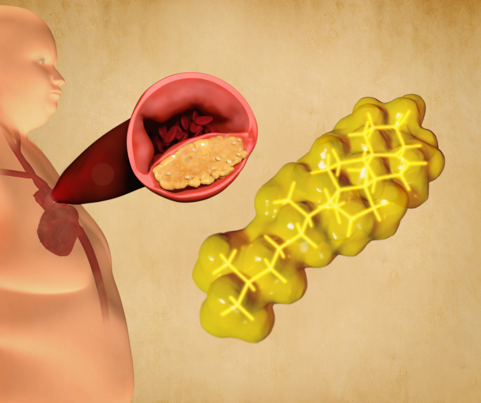 Kolesterolvärden: Vad de Betyder och Hur Du Tolkar Dina Resultat