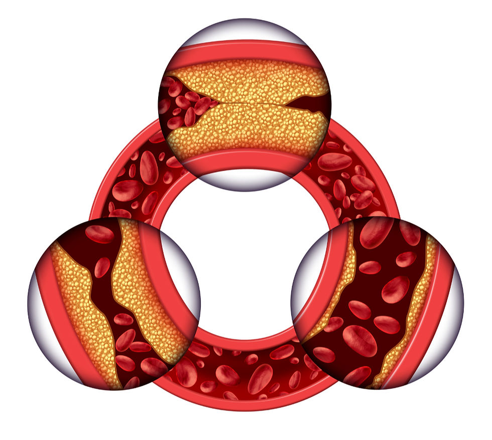 Sänka Kolesterol Snabbt – Effektiva Metoder som Verkligen Fungerar