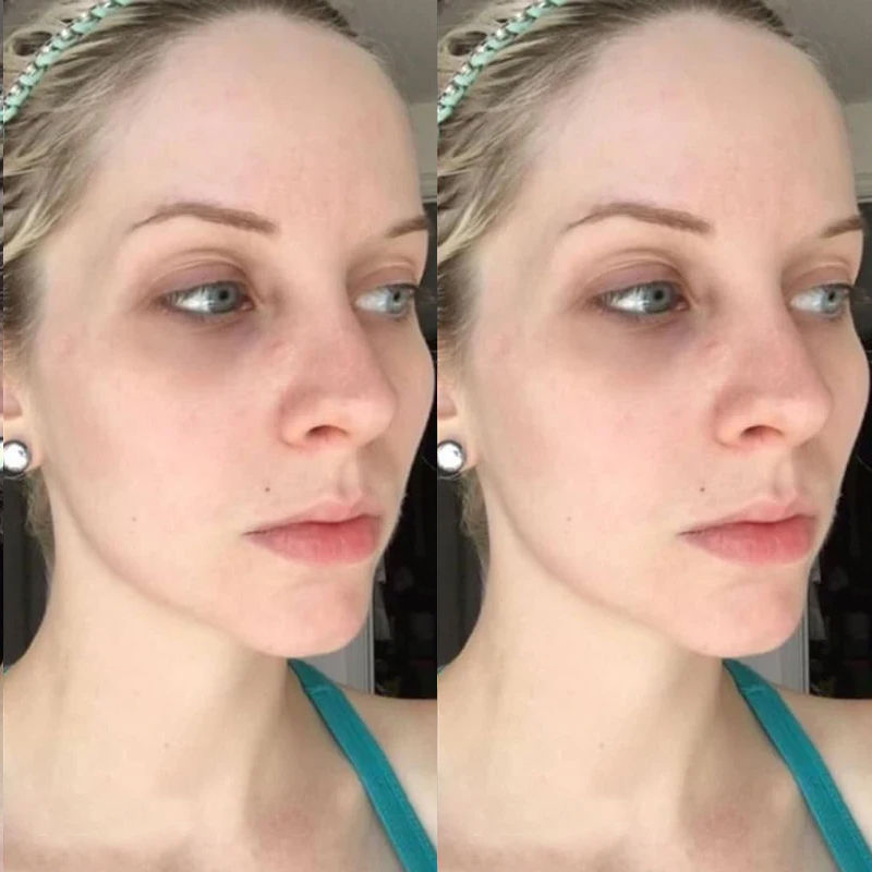 Miniatura: Korean Collagen Hyaluronic Acid Face Mask Repair Firming Lifting