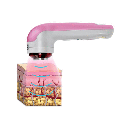 skin cure facial device - Lifting and skin tightening