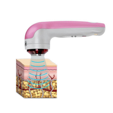 skin cure ultrasound device - Cellulite and fat reduction