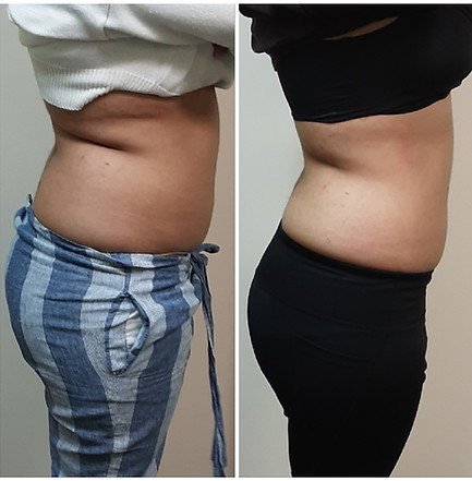 BeforeAndAfter16.jpg