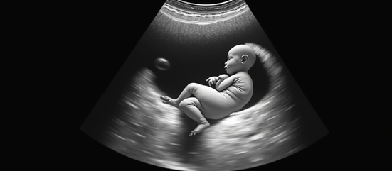 Understanding the Nuchal Translucency Scan and Its Role in Early Pregnancy Risk Assessment