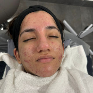 A person with eyes closed lies on a treatment table, wrapped in a white towel