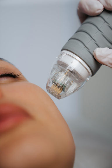 Close-up of a micro-needling device with fine needles pressed against a person’s cheek