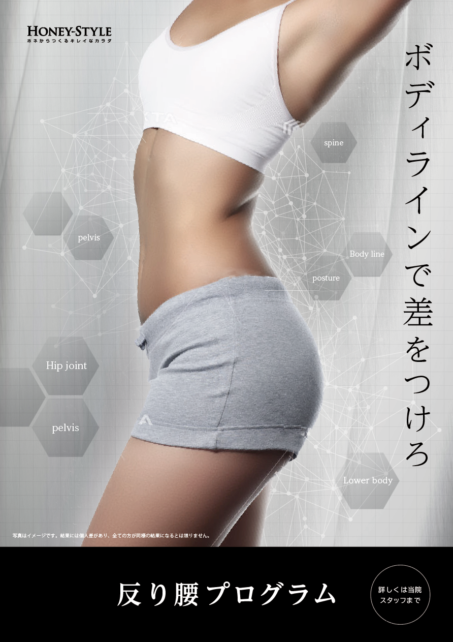 施術メニュー「反り腰」／B2ポスター