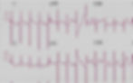 ECG readout showing heart rhythm leads for interactive learning