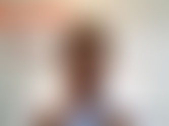 5 ERRORES que los pacientes cometen luego de una extracción dental