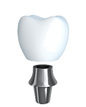 Dental-Implant-anatomy_edited.png