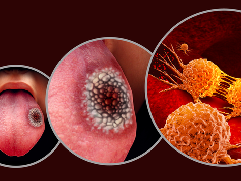 November: Shining a Light on Oral Cancer Awareness Month with Point Meadows Dentistry
