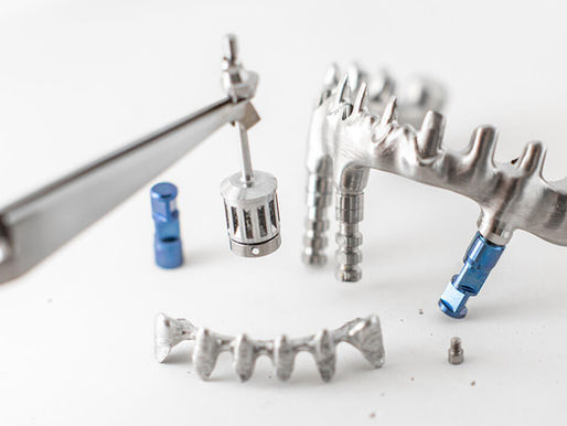 Subperiosteal Implants Offered Only at Parkway Prosthodontics
