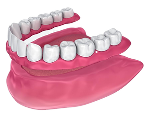 Full Dentures