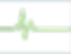 Neon green heartbeat line on a black background, displaying a spike, symbolizing life or medical theme, with a calm mood.