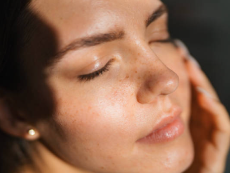 The All-In-One Skin Solution: From Wrinkle Reduction to Acne Repair with SQT