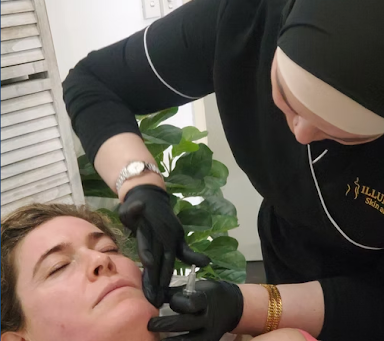 Thinking of SQT Microneedling? Here's What to Know About Prices, Aftercare & Certified Clinics Near You