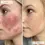 Thumbnail: Omnilux Contour Face