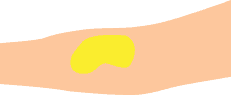 Step 3 Prp