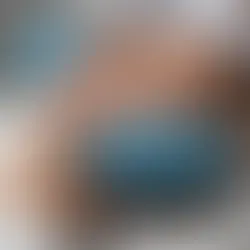 Unlocking the Benefits of EndyMed: A Comprehensive Guide to Med Spa Treatment