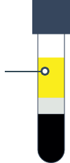 Step 2 PRP