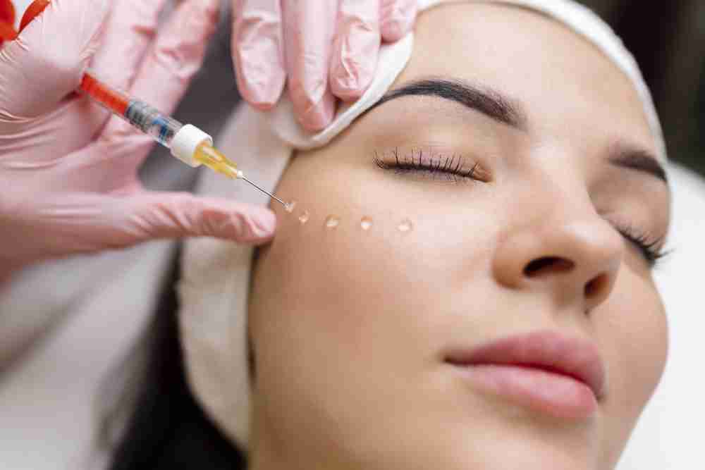 cheek filler procedure