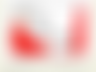 The Open Boarder Catastrophe