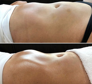 antes e depois detox corporal_edited.jpg