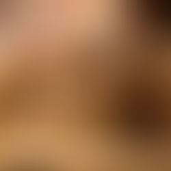 La terra che cura: oliveto circolare, autismo ed esperienze virtuose