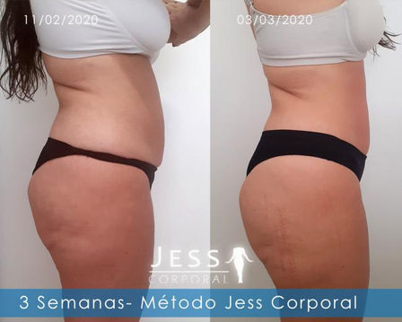 Cópia de www.jesscorporal.com.br - clinica de emagrcimento porto alegre - resultados 2 - J