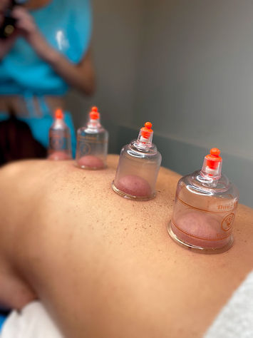 Jess Coporal - ventosa terapia , terapia com ventosas, terapeutica, dores - Clínica Avançada Porto Alegre RS