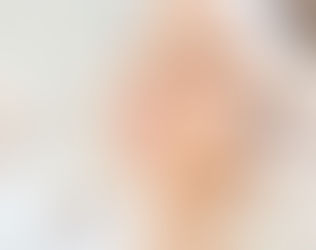 "Harmonização Facial: A Arte de Realçar a Beleza Natural"