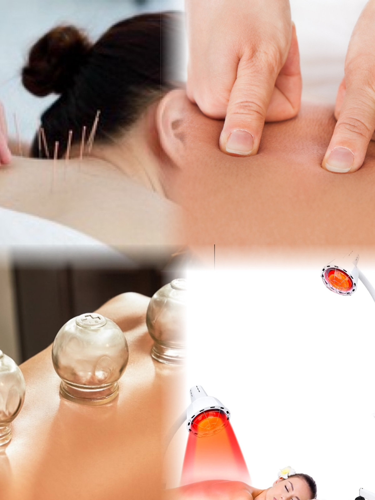Acupuncture treatment in session