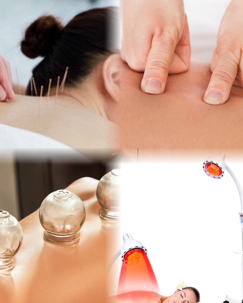 Woman receiving acupuncture treatment