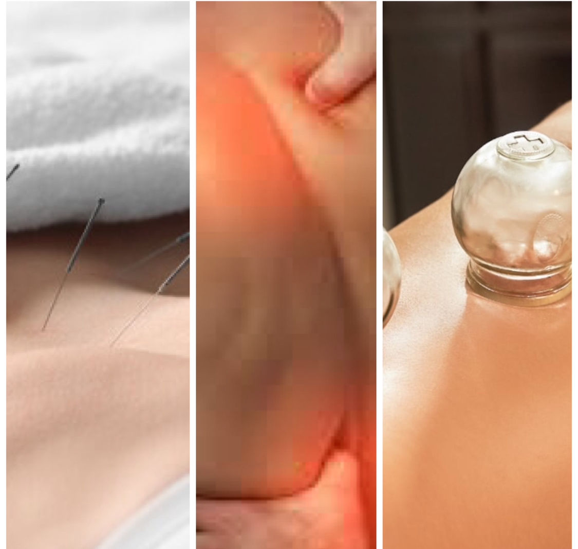 12 sessions of Acupuncture+Acupressure+(Infrared Light Therapy Or Cupping)