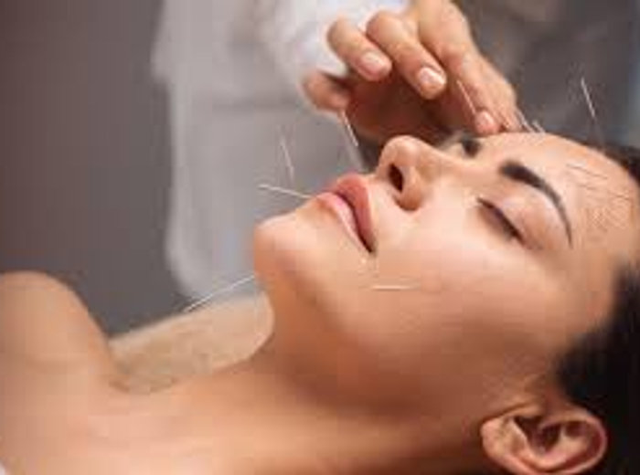 Aesthetic acupuncture treatment