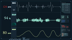 animation-fast-electrocardiogram-reading-display-heartbeats-are-getting-more-intense.jpg