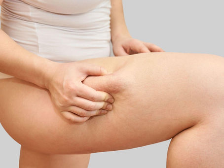 Body Contouring Treatment Myrtle Beach, SC: Shape Your Body