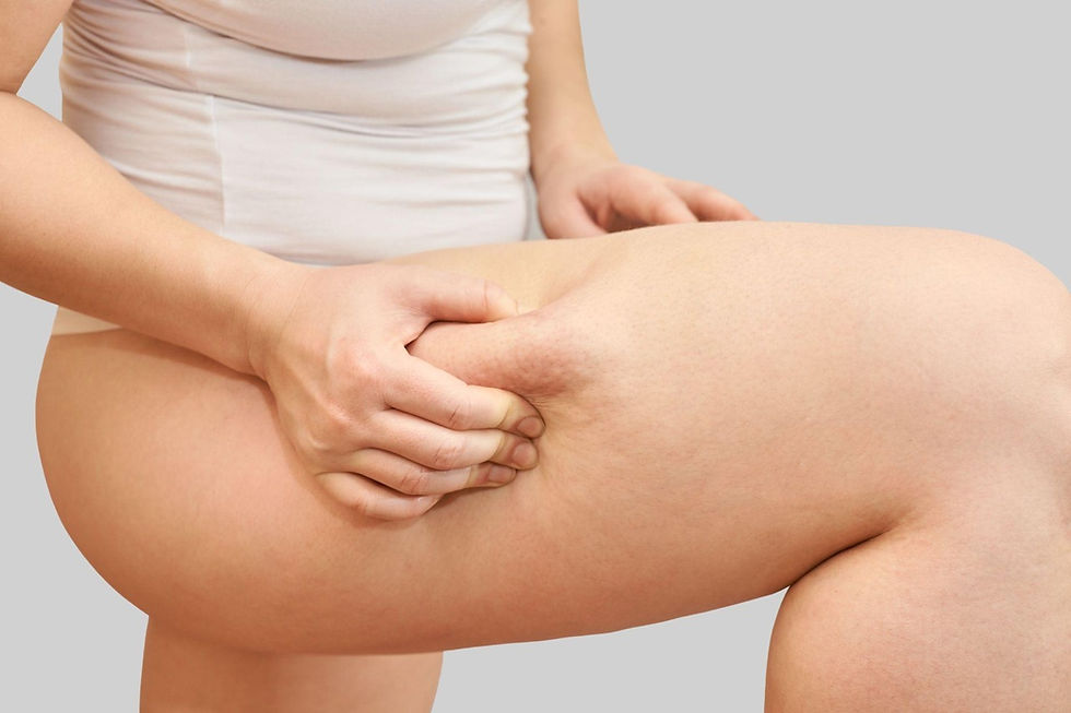 Body Contouring Treatment Myrtle Beach, SC: Shape Your Body