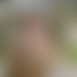 റമദാൻ നോമ്പും അലർജി നിയന്ത്രണവും: നിങ്ങൾ അറിഞ്ഞിരിക്കേണ്ട കാര്യങ്ങൾ.. Ramadan Fasting and Allergy Management: What You Need to Know