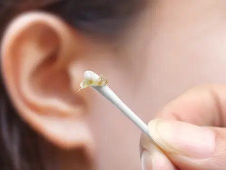 What happens when you use buds: Earwax becomes the villain