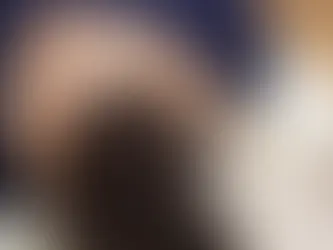 പാരമ്പര്യമായി ഉണ്ടാകുന്ന കഷണ്ടി (Male/Female Pattern Baldness); PRP ചികിത്സ ഫലപ്രദമാണോ? Is PRP treatment effective for male/female pattern baldness?