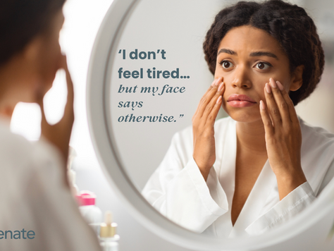 Why Your Face Looks Tired—Even When You’re Not