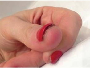 Why you shouldn’t use an at-home gel polish kit