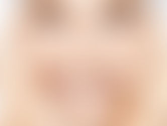 What to know about FACIAL PEELS