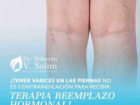 La Menopausia y las Várices