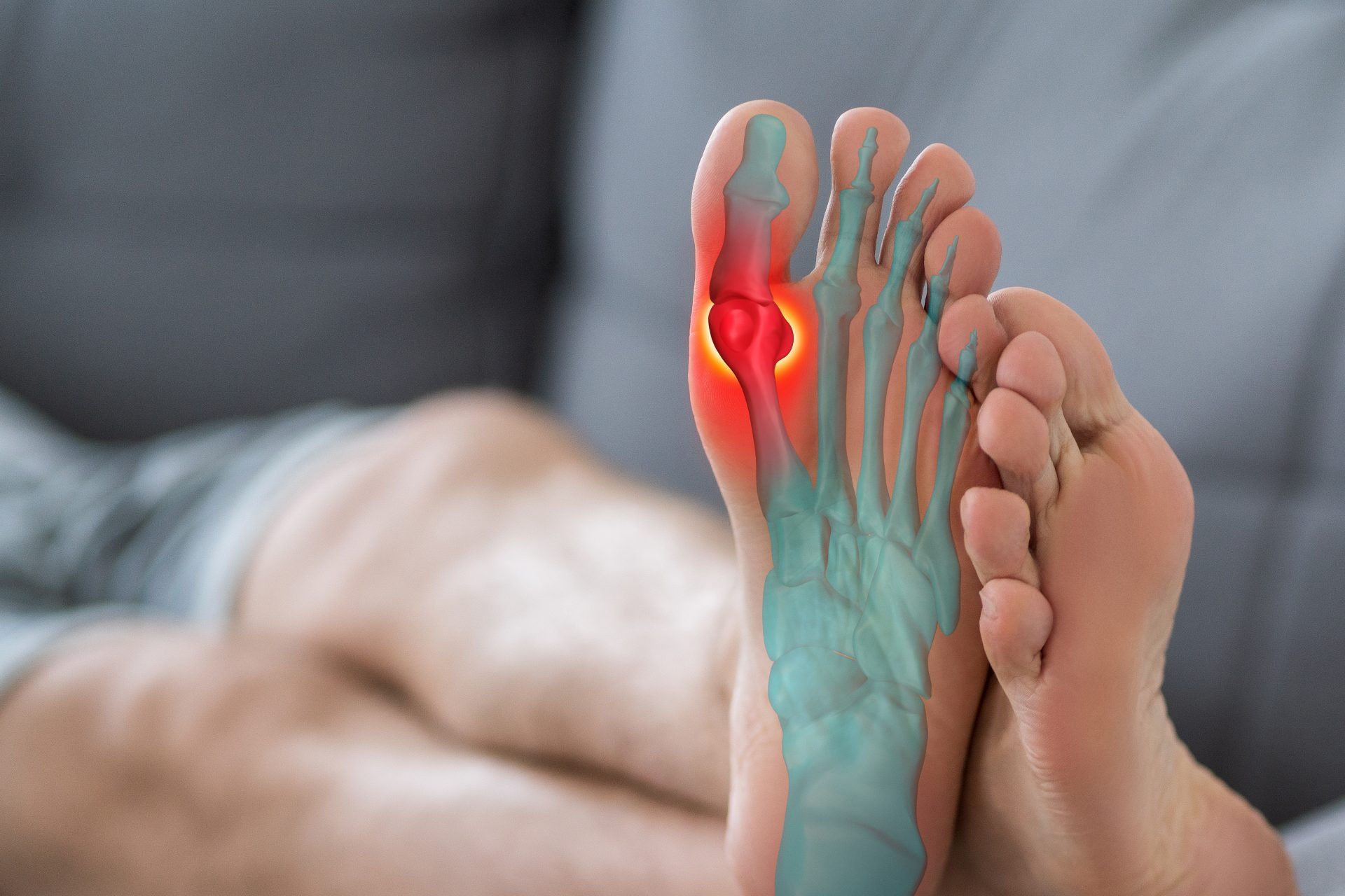 Sesamoiditis